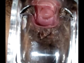 SLIM INDIAN BROWN Damsel CERVIX SPECULUM CHECK VAGINAL OPENING